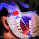 Le 10 regole d’oro per denti sani e belli